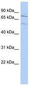 Zinc Finger Protein 395 antibody, TA345257, Origene, Western Blot image 