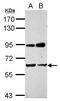 Nuclear Prelamin A Recognition Factor antibody, GTX115821, GeneTex, Western Blot image 
