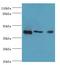 Ataxin 3 antibody, LS-C369301, Lifespan Biosciences, Western Blot image 