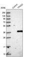 Tubulin Polyglutamylase Complex Subunit 2 antibody, NBP1-85063, Novus Biologicals, Western Blot image 