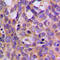 Ribosomal Protein S6 Kinase B1 antibody, LS-C354090, Lifespan Biosciences, Immunohistochemistry frozen image 