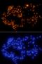Pancreatic And Duodenal Homeobox 1 antibody, MAB2419, R&D Systems, Immunofluorescence image 