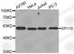 SP110 Nuclear Body Protein antibody, A3608, ABclonal Technology, Western Blot image 