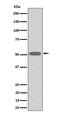 Thromboxane A2 Receptor antibody, M01812, Boster Biological Technology, Western Blot image 