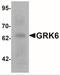 G Protein-Coupled Receptor Kinase 6 antibody, NBP2-41248, Novus Biologicals, Western Blot image 