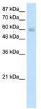 Transcriptional repressor p66-beta antibody, TA345293, Origene, Western Blot image 