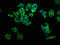Unc-5 Netrin Receptor B antibody, LS-C674559, Lifespan Biosciences, Immunofluorescence image 