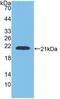Glucosidase Alpha, Acid antibody, abx131283, Abbexa, Western Blot image 