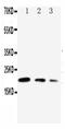 Cell Division Cycle 42 antibody, PA1366, Boster Biological Technology, Western Blot image 