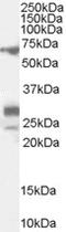 Spalt Like Transcription Factor 4 antibody, LS-C55431, Lifespan Biosciences, Western Blot image 