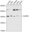 AlkB Homolog 3, Alpha-Ketoglutaratedependent Dioxygenase antibody, 19-870, ProSci, Western Blot image 