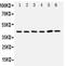 Translocation Associated Membrane Protein 1 antibody, PA2010, Boster Biological Technology, Western Blot image 