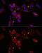 Inhibitor Of Nuclear Factor Kappa B Kinase Subunit Epsilon antibody, GTX55673, GeneTex, Immunofluorescence image 