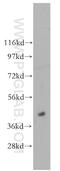 Cytosolic acyl coenzyme A thioester hydrolase-like antibody, 51016-2-AP, Proteintech Group, Western Blot image 