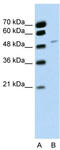 RNA Binding Motif Protein 22 antibody, TA343867, Origene, Western Blot image 