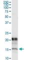 Potassium voltage-gated channel subfamily E member 1 antibody, H00003753-M13, Novus Biologicals, Immunoprecipitation image 