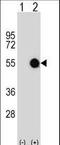 Makorin Ring Finger Protein 2 antibody, LS-C158147, Lifespan Biosciences, Western Blot image 