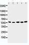 Abl Interactor 2 antibody, PA2068, Boster Biological Technology, Western Blot image 