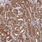 HAUS Augmin Like Complex Subunit 2 antibody, HPA039965, Atlas Antibodies, Immunohistochemistry paraffin image 