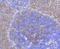 Eukaryotic Translation Initiation Factor 4E antibody, NBP2-66802, Novus Biologicals, Immunohistochemistry paraffin image 