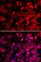 Glutaminyl-TRNA Synthetase antibody, LS-C346155, Lifespan Biosciences, Immunofluorescence image 