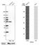 Hepatocyte Nuclear Factor 4 Alpha antibody, NBP1-89679, Novus Biologicals, Western Blot image 