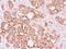 Aldehyde Dehydrogenase 1 Family Member B1 antibody, NBP1-32569, Novus Biologicals, Immunohistochemistry frozen image 