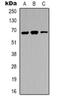 Interleukin 1 Receptor Associated Kinase 3 antibody, orb318971, Biorbyt, Western Blot image 