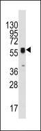 Thymidine Phosphorylase antibody, LS-C100879, Lifespan Biosciences, Western Blot image 