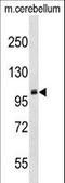 Protein Arginine Methyltransferase 9 antibody, LS-C158736, Lifespan Biosciences, Western Blot image 