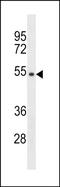 Transmembrane Protein With Metallophosphoesterase Domain antibody, PA5-49180, Invitrogen Antibodies, Western Blot image 