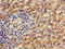4-trimethylaminobutyraldehyde dehydrogenase antibody, orb47283, Biorbyt, Immunohistochemistry paraffin image 