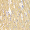 Calpain 1 antibody, LS-C331321, Lifespan Biosciences, Immunohistochemistry paraffin image 