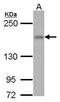 Rho Associated Coiled-Coil Containing Protein Kinase 1 antibody, PA5-32219, Invitrogen Antibodies, Western Blot image 