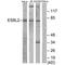 EPS8 Like 2 antibody, PA5-49879, Invitrogen Antibodies, Western Blot image 