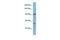 ATPase Sarcoplasmic/Endoplasmic Reticulum Ca2+ Transporting 1 antibody, GTX47068, GeneTex, Western Blot image 