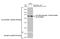 Ribosomal Protein S6 Kinase B1 antibody, GTX635621, GeneTex, Western Blot image 