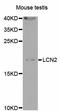 Lipocalin 2 antibody, LS-C332404, Lifespan Biosciences, Western Blot image 