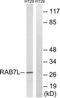 Ras-related protein Rab-7L1 antibody, TA314835, Origene, Western Blot image 