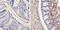 Galectin 3 antibody, GTX22785, GeneTex, Immunohistochemistry paraffin image 