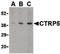 C1q And TNF Related 5 antibody, LS-B1343, Lifespan Biosciences, Western Blot image 