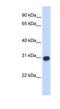 Zinc Finger MYND-Type Containing 19 antibody, NBP1-79414, Novus Biologicals, Western Blot image 