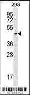 Tubulin Folding Cofactor E Like antibody, 56-421, ProSci, Western Blot image 