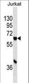 Cytochrome P450 Family 1 Subfamily A Member 1 antibody, LS-C157674, Lifespan Biosciences, Western Blot image 