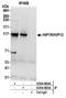 Huntingtin Interacting Protein 1 Related antibody, A304-804A, Bethyl Labs, Immunoprecipitation image 