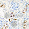 Carnitine Palmitoyltransferase 2 antibody, A2876, ABclonal Technology, Immunohistochemistry paraffin image 