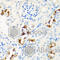 CPT2 antibody, A2876, ABclonal Technology, Immunohistochemistry paraffin image 