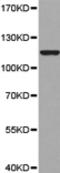 Microsomal Triglyceride Transfer Protein antibody, TA323709, Origene, Western Blot image 