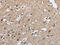 Calcium Binding Protein 39 Like antibody, CSB-PA796667, Cusabio, Immunohistochemistry paraffin image 