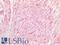 Caveolin 1 antibody, LS-B9776, Lifespan Biosciences, Immunohistochemistry paraffin image 
